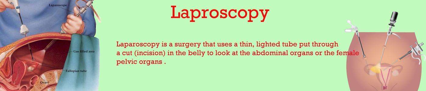 Laproscopy